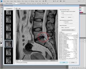 dicom1